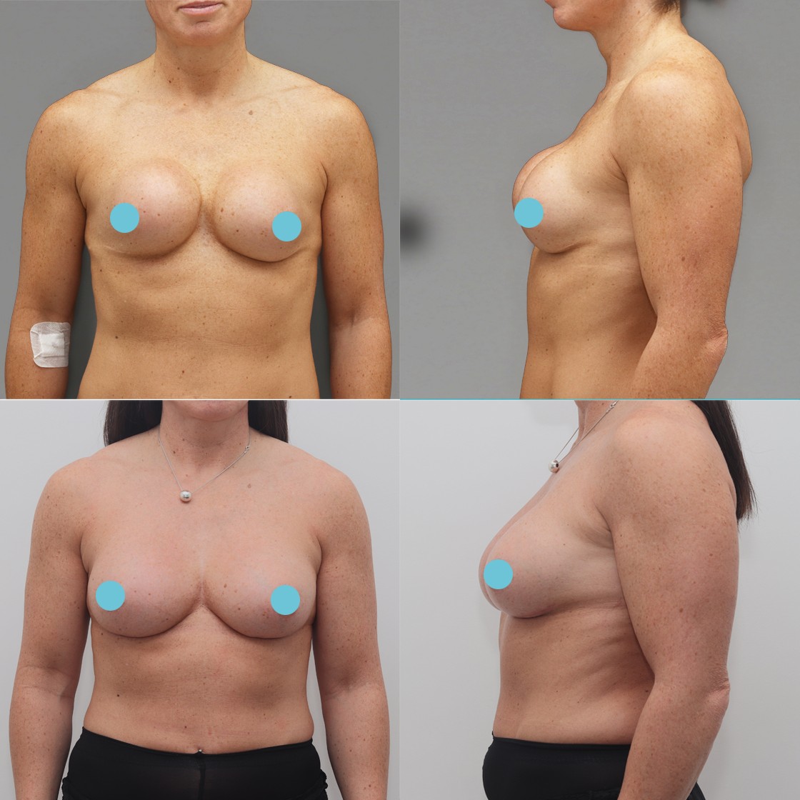 увеличилась грудь у женщин фото 61
